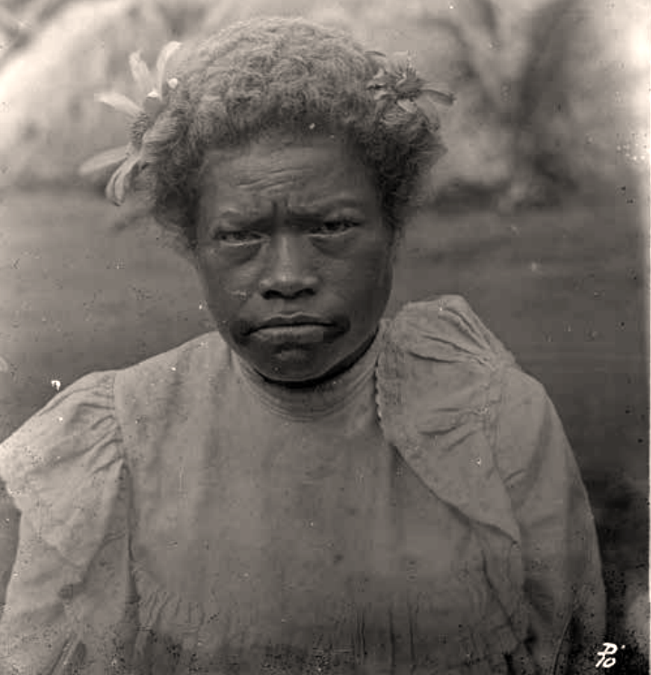 Unknown Fijian woman with qia gusu (mouth tattoos), Vanua Levu, 1910–12 — Fijian facial tattoo